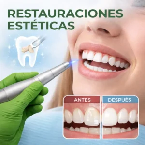 Restauración dental estética avanzada